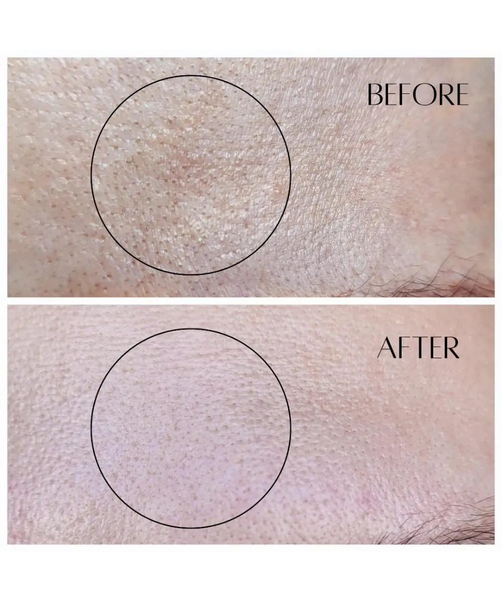 AHA   BHA - Dermal Night Treatment - 10% AHA & 1% BHA